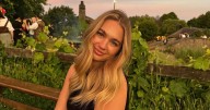 Woman's skin burns, cracks and bleeds from simple British weather change