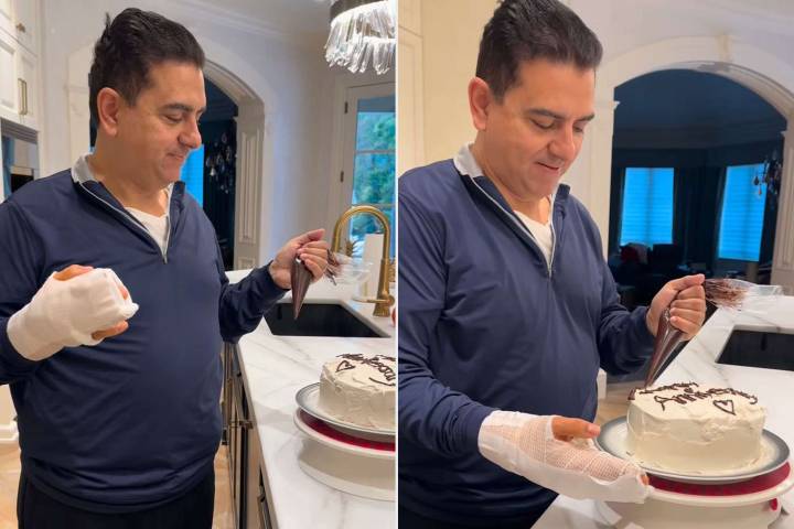 Buddy Valastro Undergoes Last Surgery After 2020 Bowling Accident