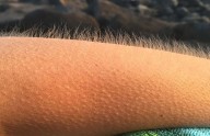 ¿Por qué se pone la “piel de gallina” al escuchar música emotiva o sentir miedo?