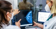 Is your mammogram accurate enough? What to know about AI and breast cancer scans