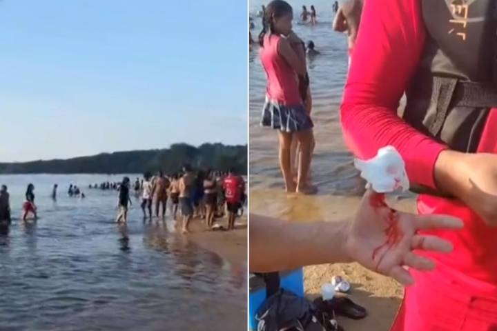 7-Month-Old Baby Among Multiple Injured in Piranha Attack at River Resort