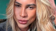 Quería tener una mirada “foxy eyes”: influencer brasileño murió luego de someterse a una cirugía estética