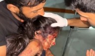 Gaza girl removes ‘stray bullet’ after being injured by an Israeli drone