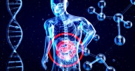 No son los genes: estudio encontró qué aumentó los casos de cáncer gástrico en menores de 50 años