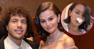 Makeup-Free Selena Gomez Shares Funny Photo of Herself With Tissues in Her Nose After Lavish Wedding to Benny Blanco