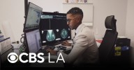 How radiologists are using AI to detect breast cancer