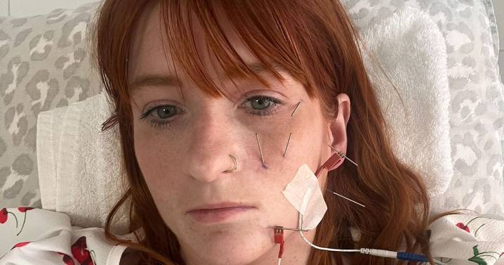 'My face became paralysed after drinking tea – now I have to tape eyes shut to sleep'