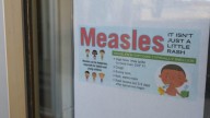 Measles outbreak reported in the Upstate: DPH