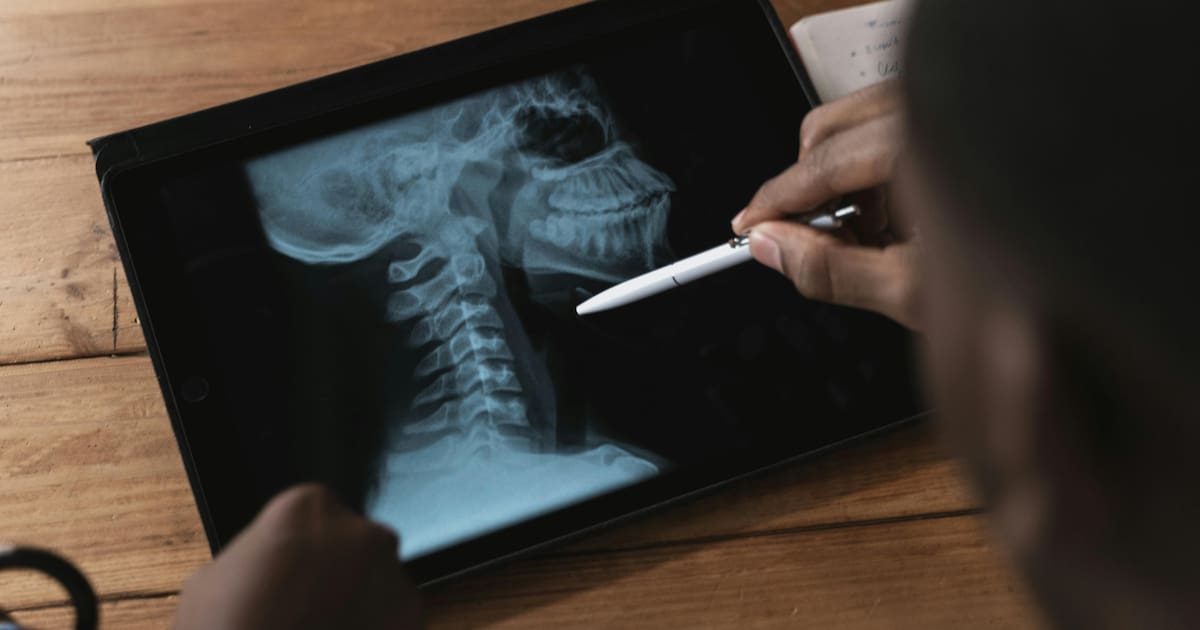 La RAE aclara: ¿Es correcto decir los cervicales o las cervicales?