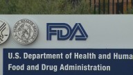 FDA clears blood test to help rule out Alzheimer's disease in people showing symptoms