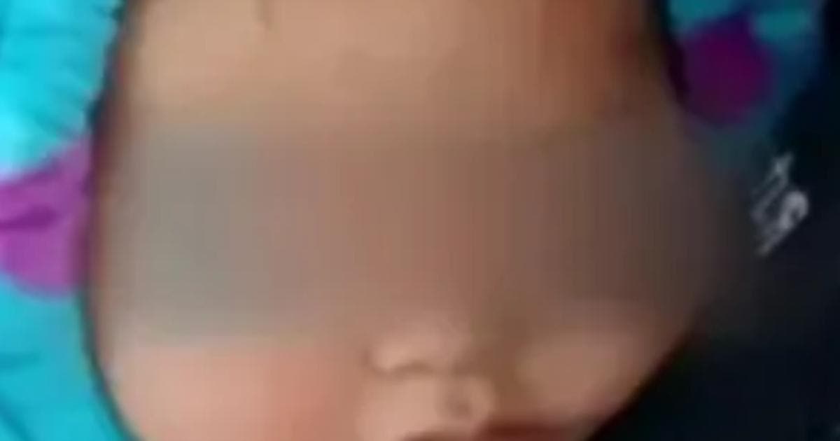 Muestra evolución favorable tras injertos, Jazlyn Azulet, nieta de la 'abuelita heroína'
