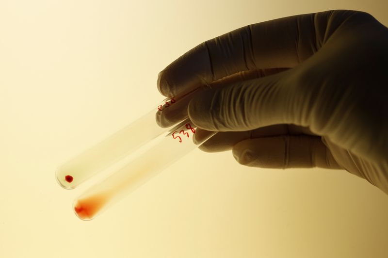 Health Rounds: Scientists change kidney blood type, a potential advance for transplant recipients