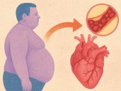 Semaglutida reduce 57% el riesgo de infarto y muerte cardiovascular: estudio