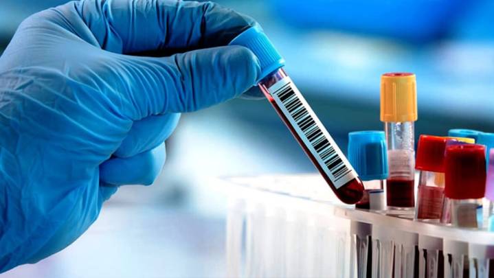 Una prueba de sangre podría confirmar el síndrome de fatiga crónica con 96% de precisión