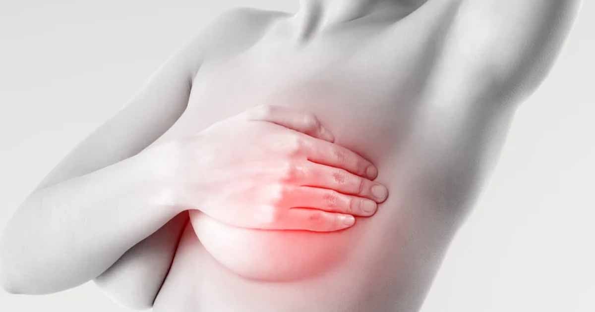 Piura: Recomiendan autoexamen de mama desde los 20 años para prevenir el cáncer