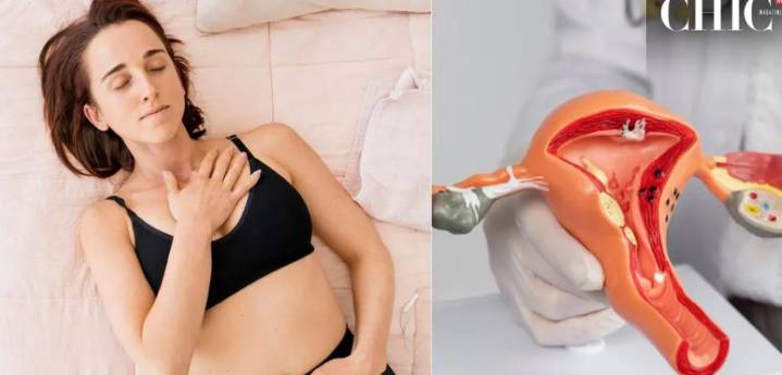 ¿Cómo es vivir 24 horas diarias con una dolorosa endometriosis? Relato de joven que pidió eutanasia