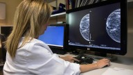 Las comunidades con menos renta registran más muertes por infarto: Extremadura, la segunda