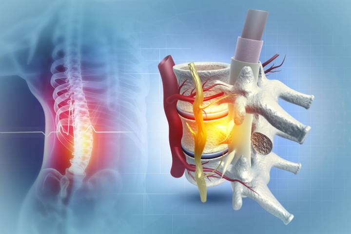 Potential Spinal Cord Therapy Using Thiorphan Uncovered by Computational Analytics