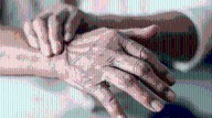 Parkinson: avances prometedores y posibles soluciones en los años venideros