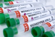 Second mpox case reported in Sindh