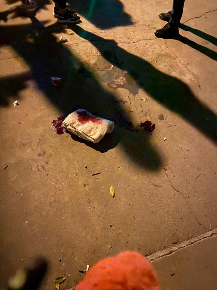 Barrio San Jorge: Imputaron a tres hombres por lesiones, habrían atacado a un joven
