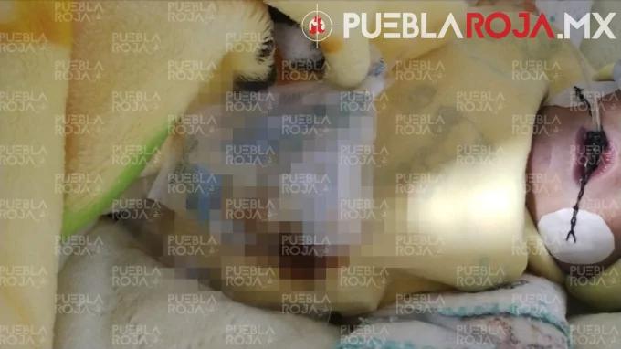 Muere recién nacido en clínica de Puebla; denuncian negligencia y encubrimiento