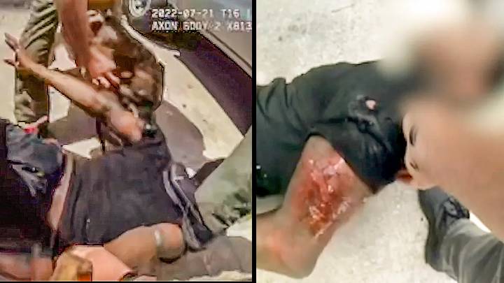 ‘Think We Have the Wrong Guy’: Innocent Black Florida Man Attacked by Cops and Mauled by K9 After ‘Matching the Description,’ Files Lawsuit