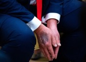 Trump’s Doctor Declares President in ‘Exceptional Health’ After Physical