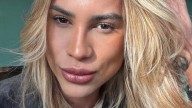 Un influencer brasileño murió luego de someterse a la cirugía estética “foxy eyes”