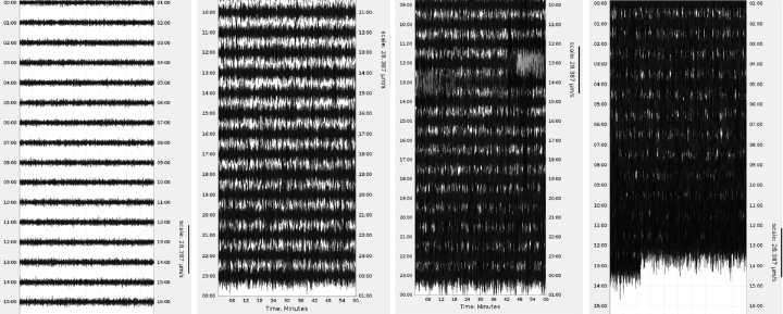 Seismometers Picked Up Hurricane Melissa’s Historic Power Like an Earthquake