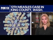 12th case of measles in King County, WA