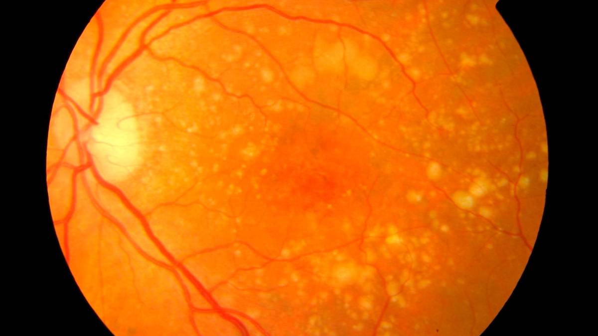 ¡Increíble avance científico! Implante ocular restaura la visión de personas ciegas