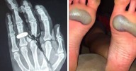 28 Medical Pics That Prove The Body Keeps The Score, And Sometimes It’s Absolutely Terrifying