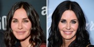 11 Celebrities Who Dissolved Their Fillers or Stopped Getting Them
