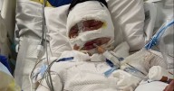 Teen fighting for life in hospital after being 'doused in petrol and set alight'