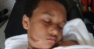 Boy, 9, recalls horror moment he almost died after charger caught fire  in bed
