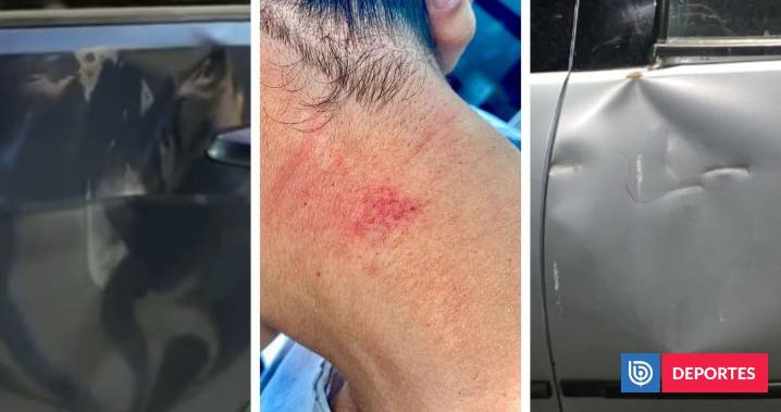 Escándalo en clásico Newell’s-Rosario de futsal en Argentina: mordidas, autos rotos y denuncia