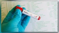 Panola County cat euthanized after showing symptoms of rabies
