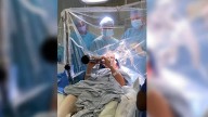 VIDEO | Mujer con Parkinson tocó un instrumento durante importante cirugía cerebral en Inglaterra