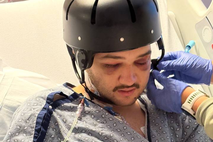 ‘An absolute nightmare’: Dedham man suffers brain injury after assault near Fenway Park, his mother says