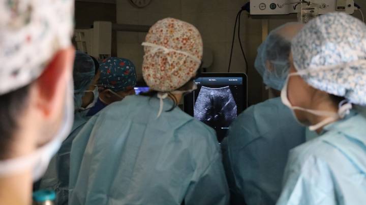 Una quincena de pacientes oncológicos del Hospital del Mar ya se han beneficiado de la electroporación