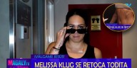 Melissa Klug se somete a abdominoplastia, reducción de mamas, y más tras ruptura con Jesús Barco: “Me duele hasta el ojo”