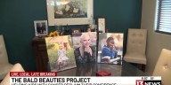 Bald Beauties Project helps Tucson kids with cancer reclaim confidence through photo shoots