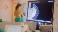 Los técnicos habrían recibido órdenes de no avisar de las mamografías dudosas porque lo haría un programa informático