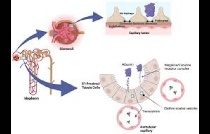 Lowering Albuminuria Improves Survival and Kidney Outcomes in Diabetes