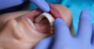 Gum Disease May Raise Stroke Risk, Even Damage the Brain