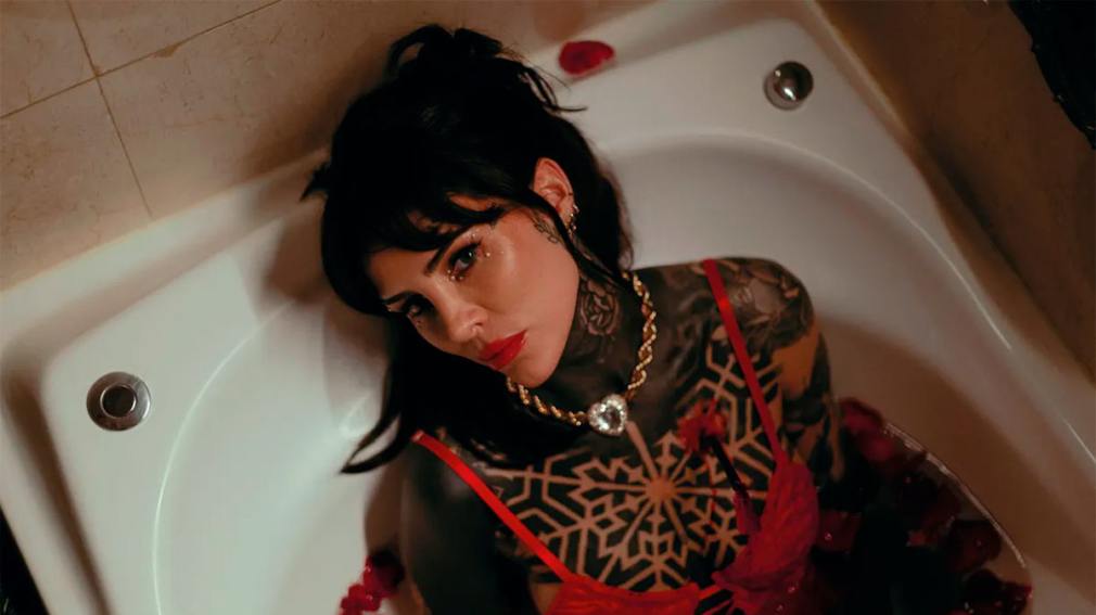 Cande Tinelli sufrió un accidente y debió ser operada: qué le pasó
