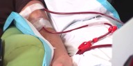 At-home dialysis now available in Arizona gives comfort in treatment