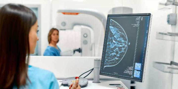 ¿A qué edad deben comenzar las mamografías y cada cuánto deben hacerse?
