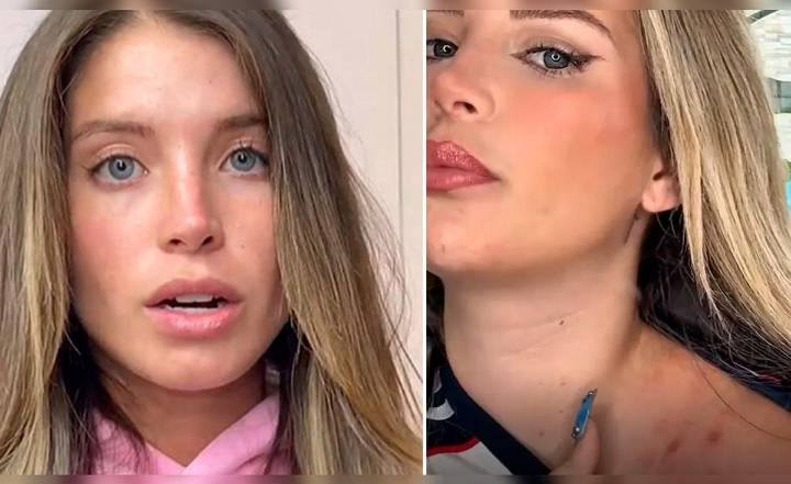 Flavia Laos confiesa que le detectaron delicada enfermedad que no tiene cura: "Mi cuerpo habló por sí solo"